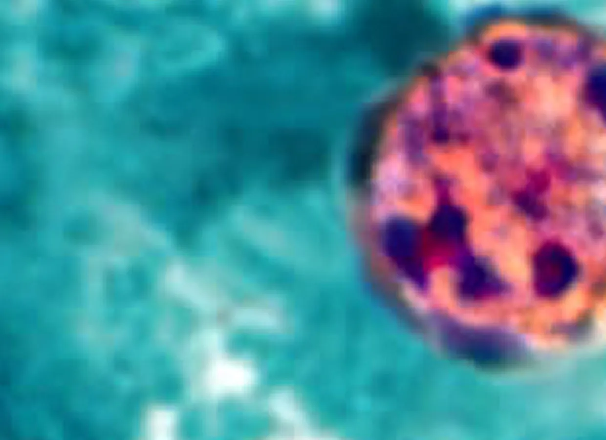 Cyclospora CP Shome